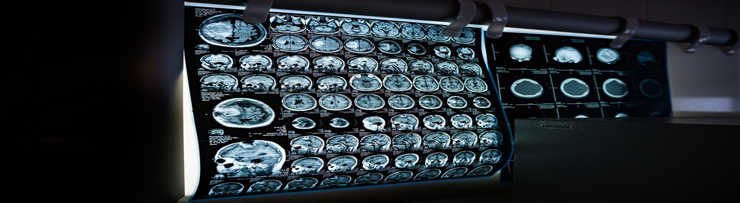 Neurocrine Biosciences, Inc.